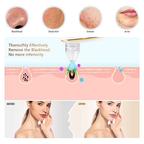 Beauty Acne Black Head Vacuum Pore Cleaner