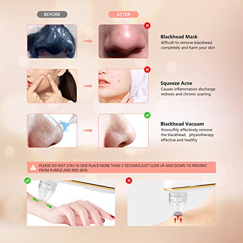Beauty Acne Black Head Vacuum Pore Cleaner